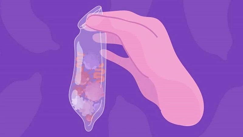 بعد از سوزاندن زگیل تناسلی چه باید کرد؟